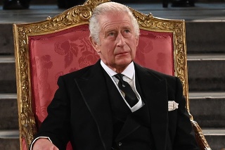 Bystré oči fanúšikov kráľovskej rodiny si všimli, že kráľa Karola III. trápi silný opuch prstov. 