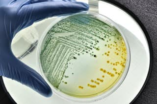 E. coli bacteria growing in laboratory dish inspected in a food laboratory