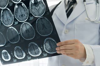 Vedci objavili mozgové signály chronickej bolesti, objav by mohol pomôcť v liečbe (ilustračné foto)