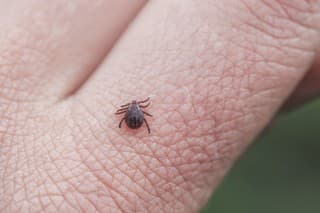 dangerous infectious insect mite crawls on the skin of the fingers of the human hand to suck the blood