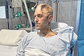 Štefan Bazso je po štyroch amputáciách končatín a časti lebky stále v opatere lekárov.
