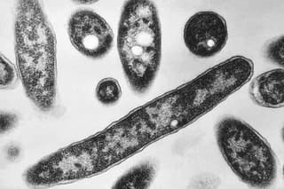 Na snímke z mikroskopu z roku 1978, ktorú sprístupnilo Centrum pre kontrolu a prevenciu chorôb, sú zobrazené baktérie Legionella pneumophila, zodpovedné za spôsobenie pľúcnej choroby známej ako legionárska choroba.