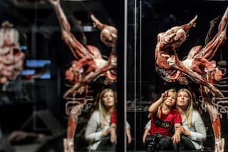 Podľa usporiadateľov má výstava ukázať anatómiu ľudského tela