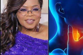 Mnohé celebrity trpia ochorením štítnej žľazy