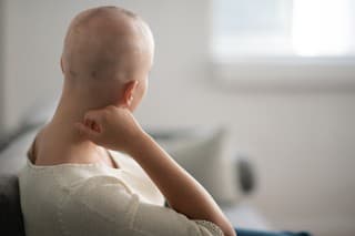 A woman is indoors in her living room. Her head is shaved due to chemotherapy. She is sitting and looking thoughtful.