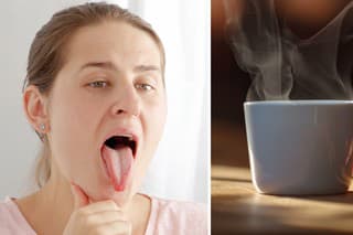 Jeden lekár varuje, že by ste mali skontrolovať svoj jazyk - môžete na ňom nájsť znak, že by ste pitie kávy mali čo najskôr obmedziť.
