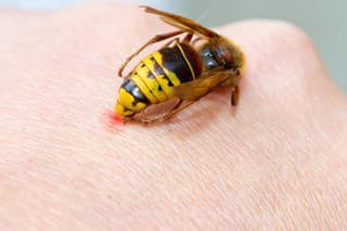 Hornet on a hand sting in the skin