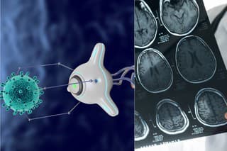 Nanoroboty by mohli pomáhať pri liečbe chorôb (ilustračná fotografia).