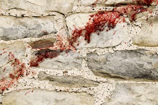 Blood splatter on stone wall.