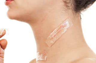 Gel sheet - treatment for scars (after surgical intervention - thyroid cancer and metastases in the lymph glands)