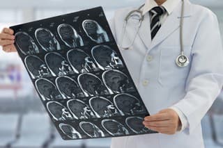 Doctor examines film x-ray brain by mri or ct scan  of the patient.