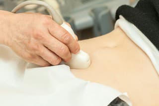 Image of mid adult woman having abdominal ultrasound. Close up of her belly with doctor's hand and ultrasound. selective focus.