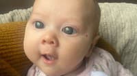 Dievčatko má krásne veľké oči: Skrýva sa však za nimi hrozivá diagnóza! Zdrvujúca spoveď rodičov
