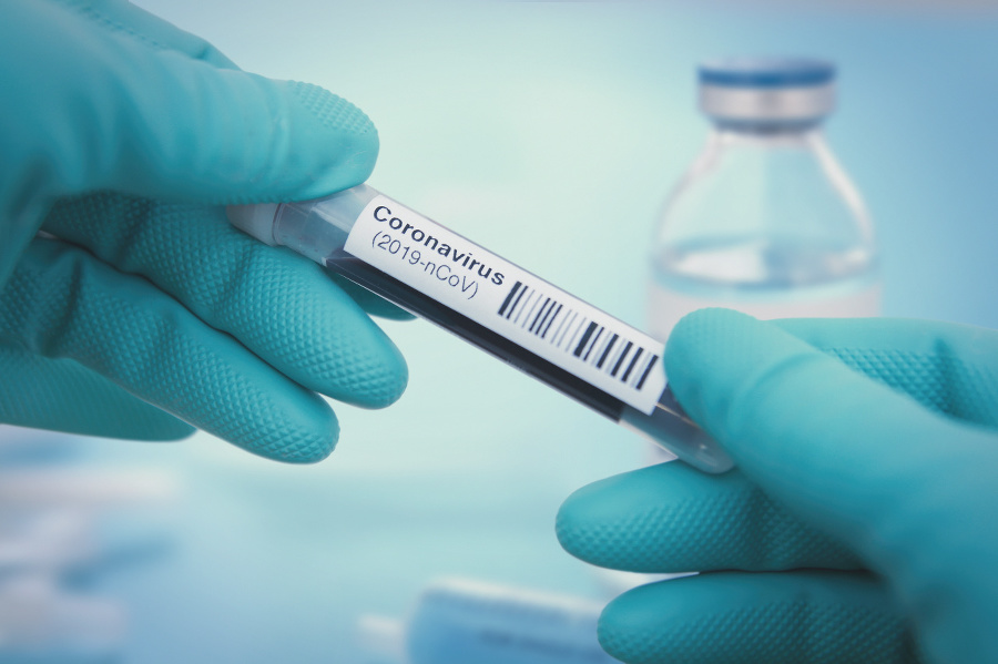 Detail of coronavirus test sample