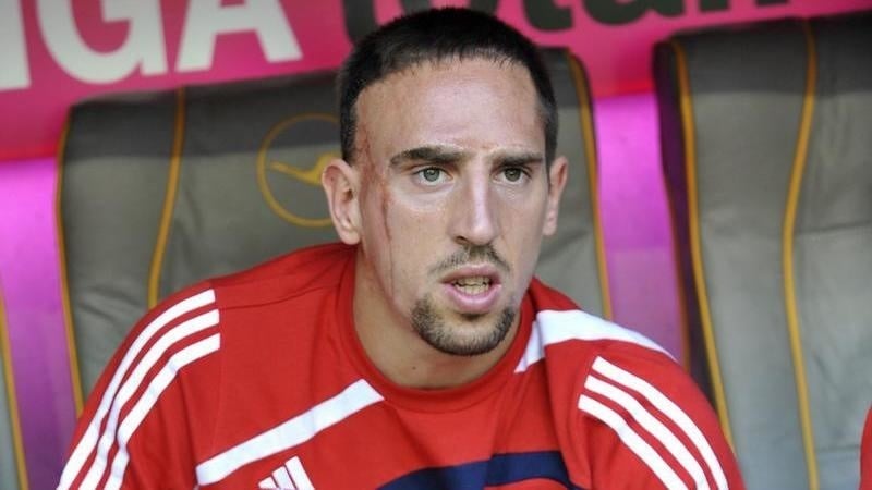Frank Ribéry
