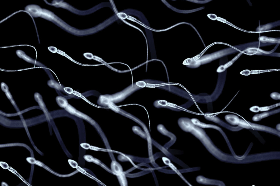Množstvo a kvalita spermií