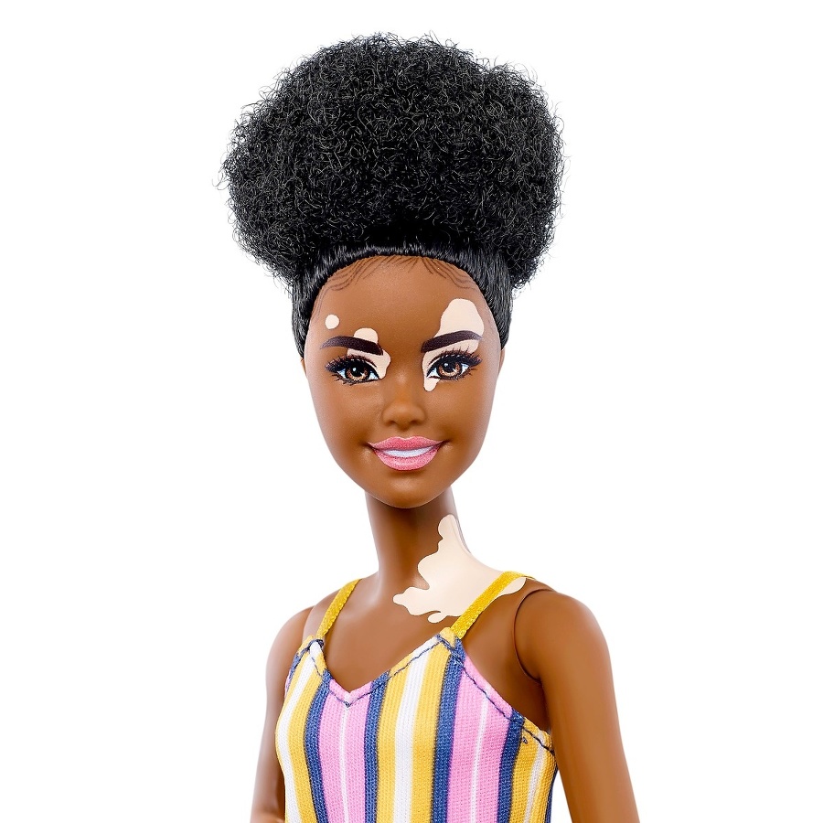 Barbie s vitiligom si
