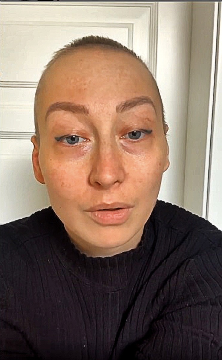 Rakovina mladú ženu obrala