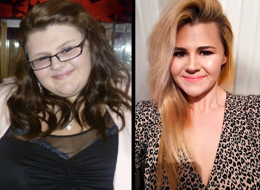Žena schudla 53 kilogramov