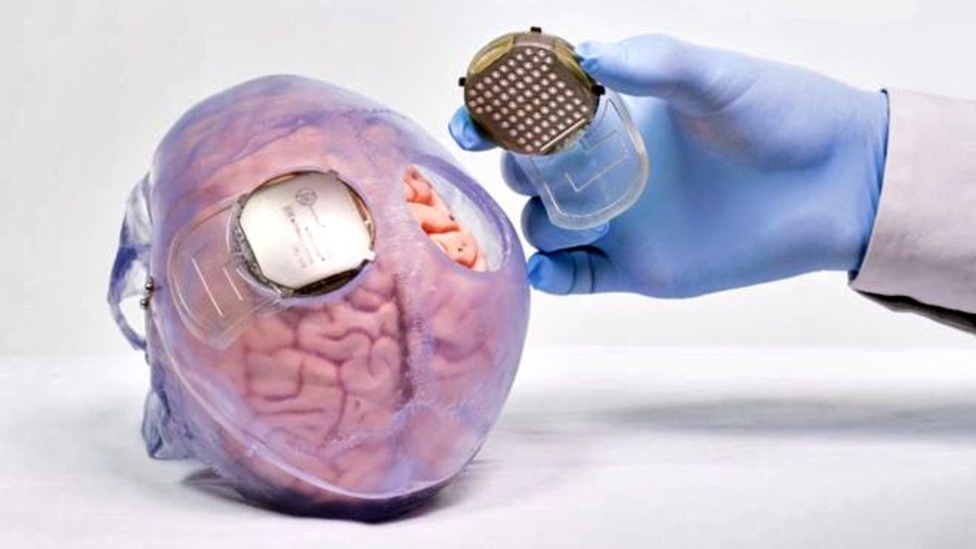 Senzori implantované v hlave