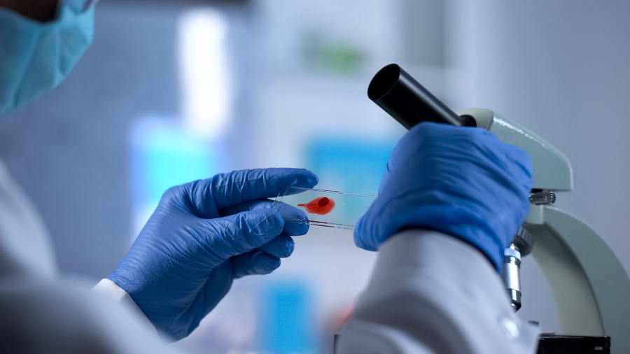 AIDS checkup, researcher preparing