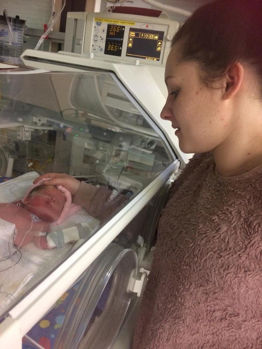 Lilee-Rose bola po narodení 20 týždňov v nemocnici.