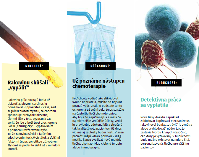 Kam sme sa posunuli