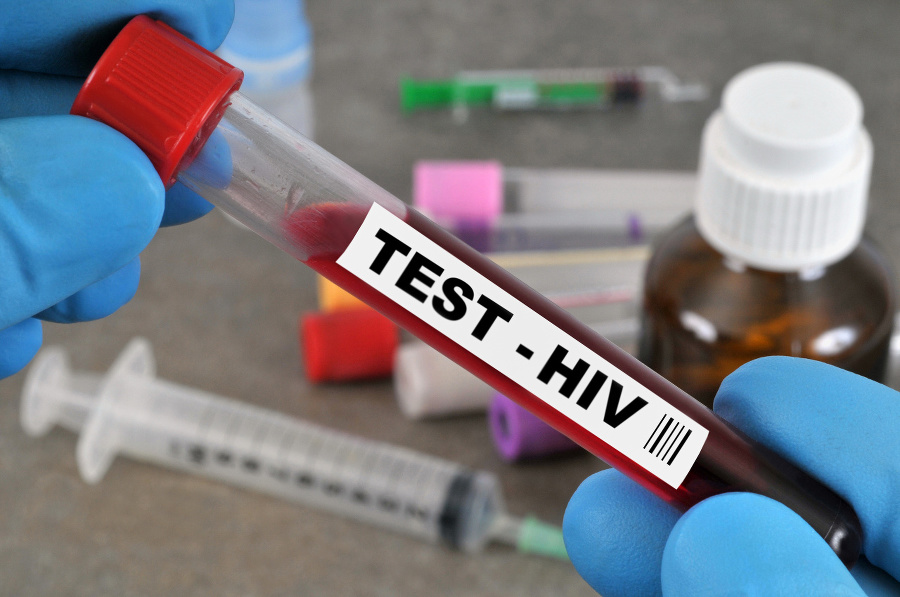 Test sanguin du sida