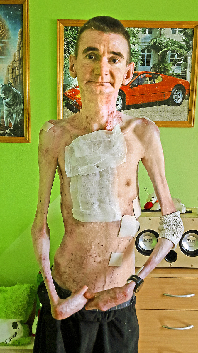 Kristián má celé telo posiate krvácajúcimi ranami.