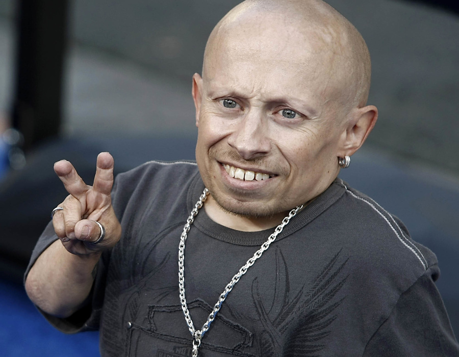 Americký herec Verne Troyer