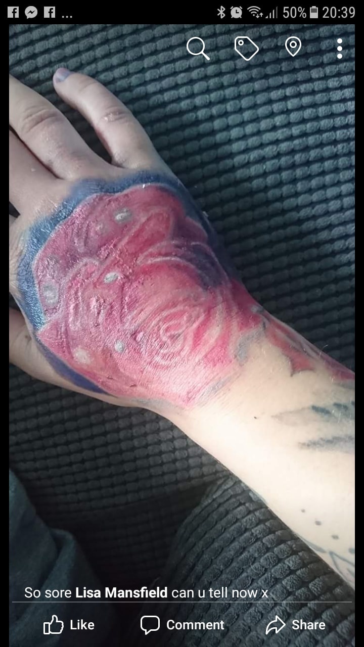 Matke tetovanie zjazvilo ruku.