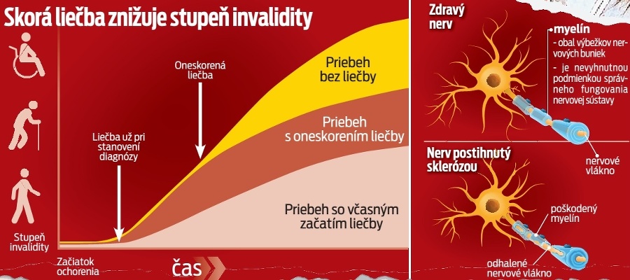 Skorá liečba znižuje stupeň