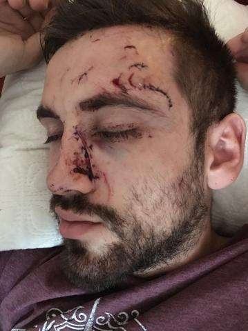 Marek utŕžil hlboké rany na tvári.