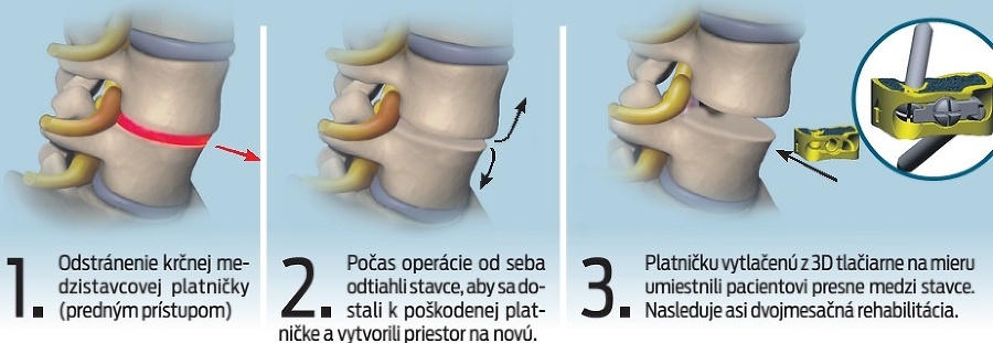 Ako prebiehal zákrok.