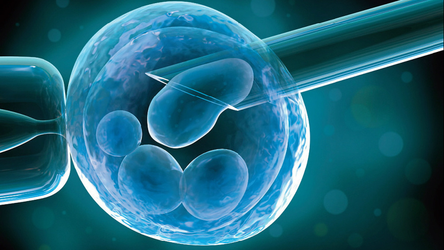 Proces mimotelového oplodnenia (IVF)