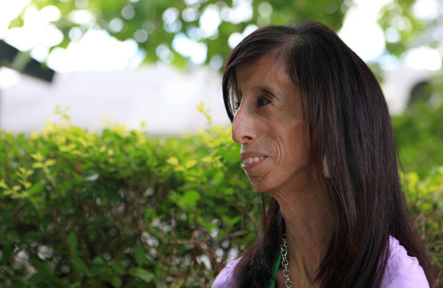 Lizzie Velasquez