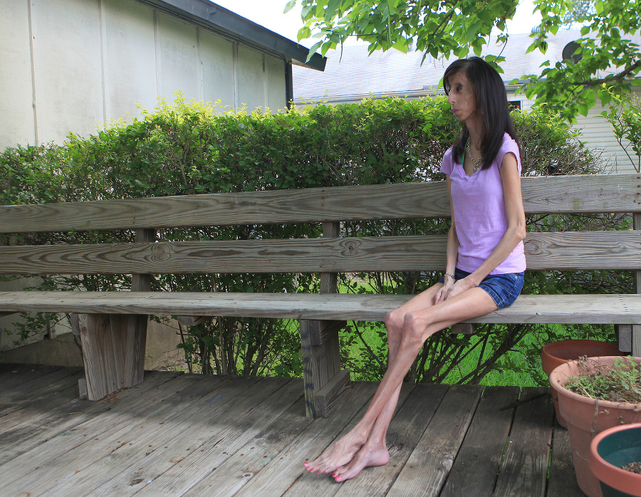 Lizzie Velasquez