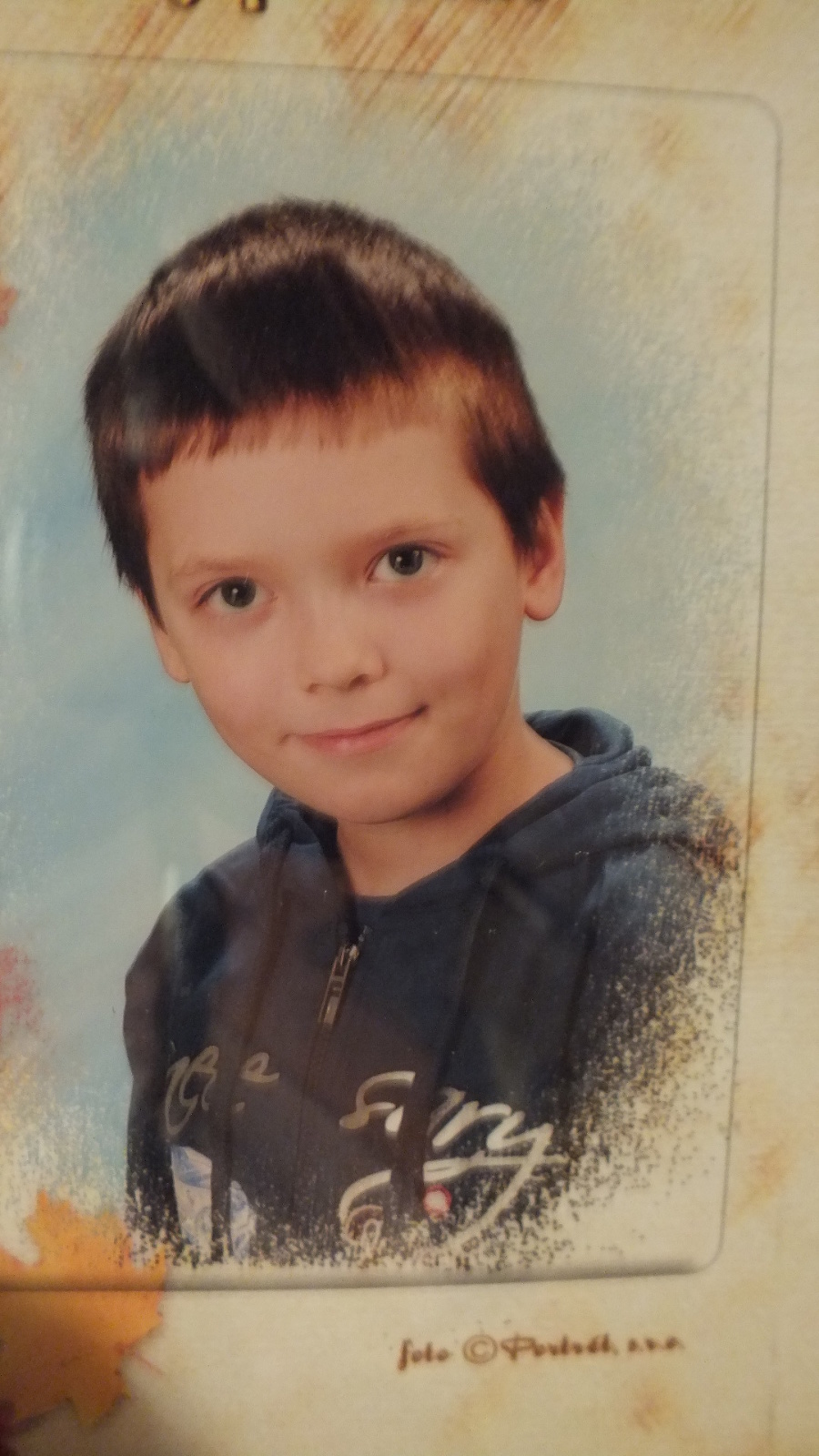 Lukáško (11 )po dokopaní koňmi skončil v nemocnici.