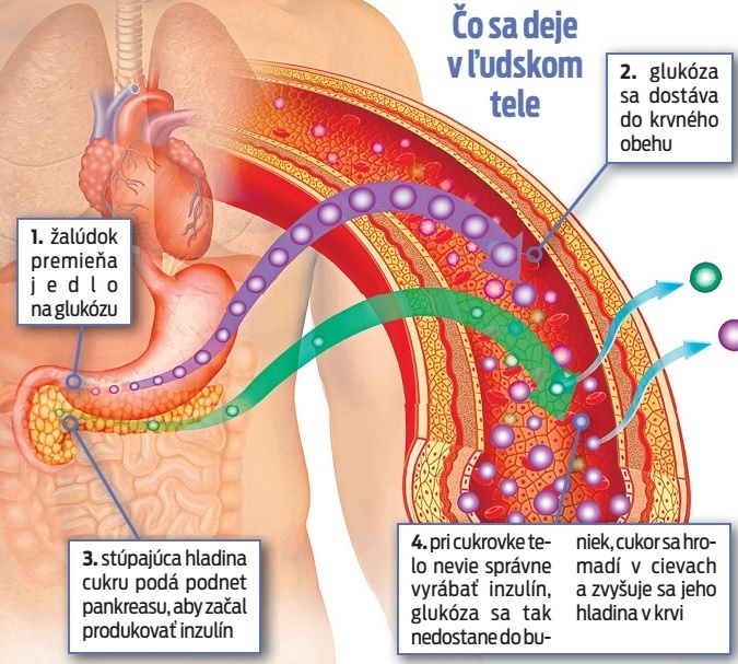 Čo sa deje v