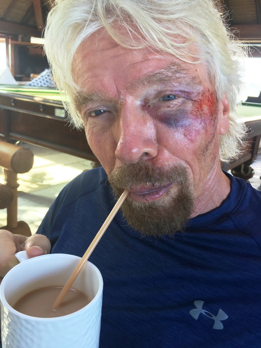 Richard Branson po nehode