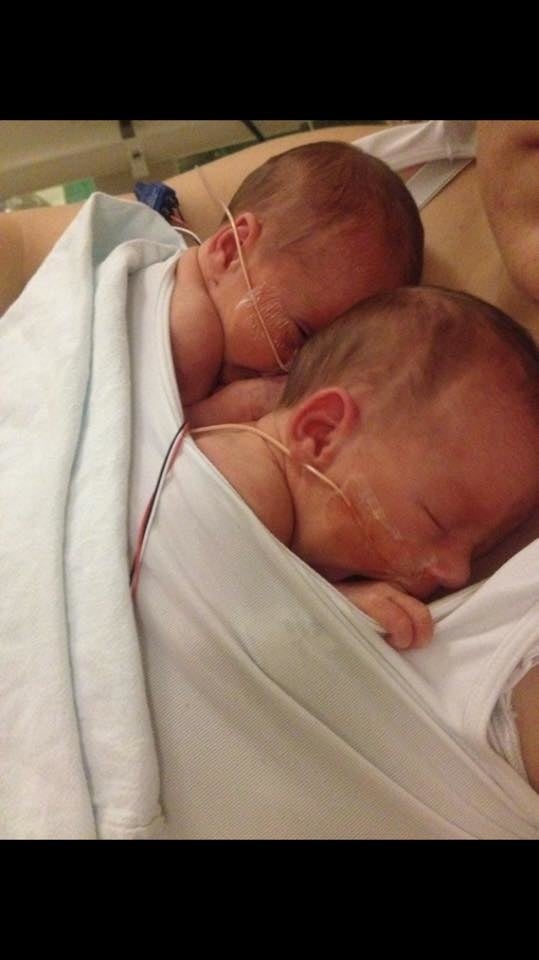 Dvojičky sa po narodení