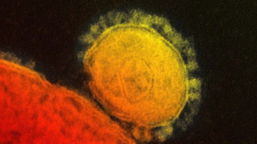Zafarbený koronavírus MERS.