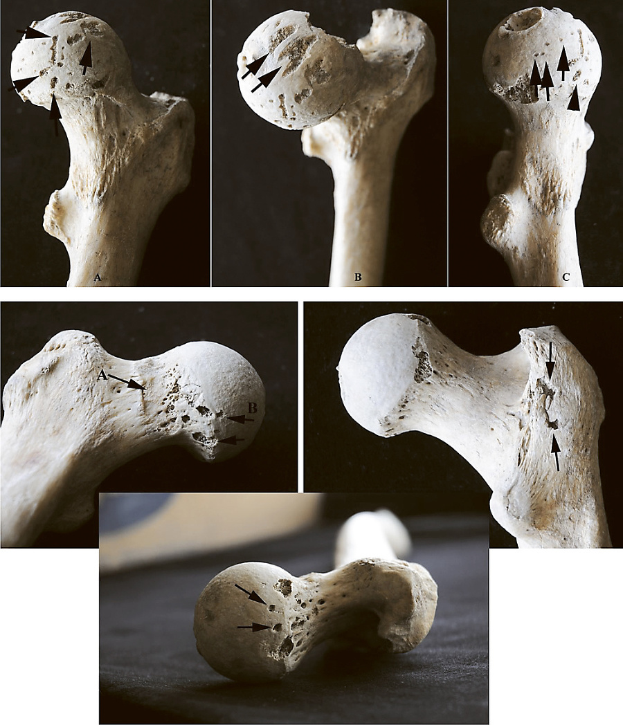 Ľudská kosť z obetnej