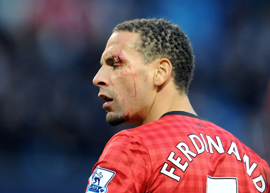 Rio Ferdinand utrpel v