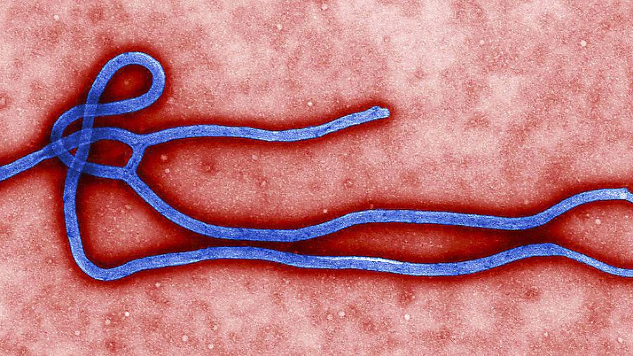 Epidémia smrteľnej tropickej choroby
ebola