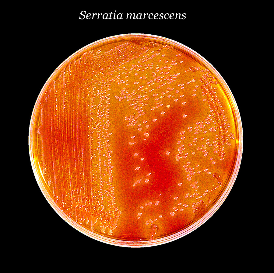 Nebezpečná baktéria Serratia Marcescens