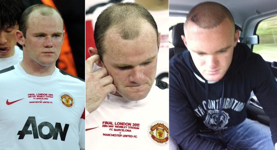 Anglický futbalista Wayne Rooney