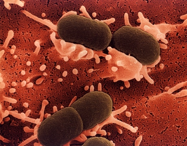 Baktéria Escherichia coli sa