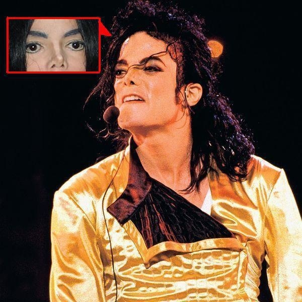 Oči Michaela Jacksona môžu