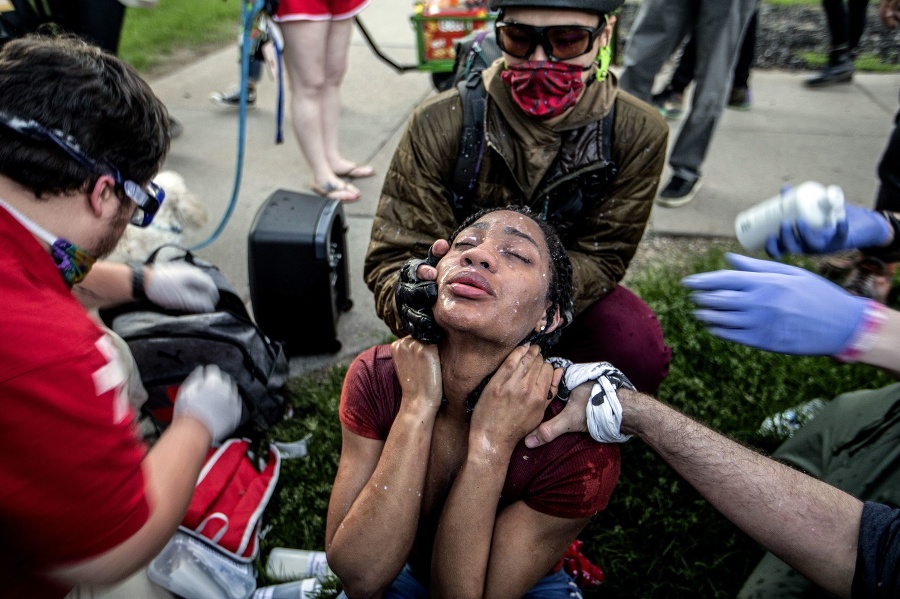 Zdravotníci ošetrujú protestujúcu počas